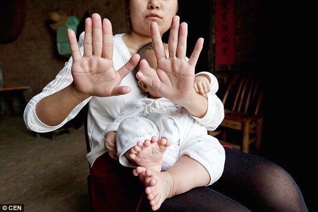Sokkot kaptak a szülők, mikor gyermekük 31 ujjal született - képek