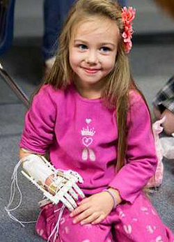 Diákoktól kapott robotkezet a kislány