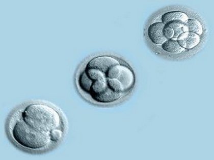 Lombik bébi program – milyen a jó embrió?