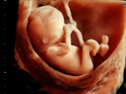 3D-s ultrahang: mintha kamerával néznénk be az anyaméhbe