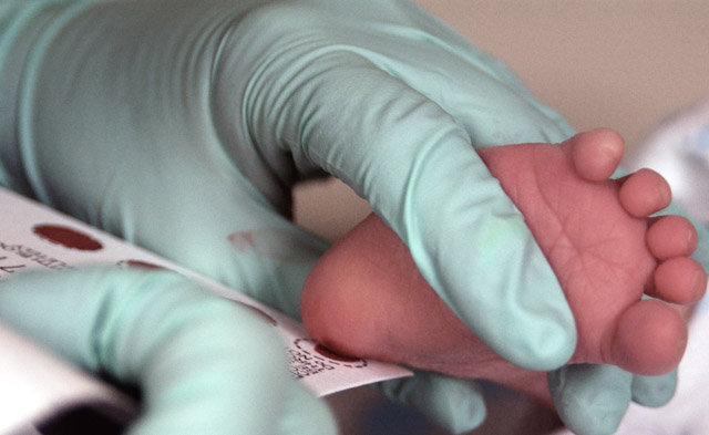Az újszülöttek sarkát megszúrják, majd elvégzik a tesztet Phenylketonuriára