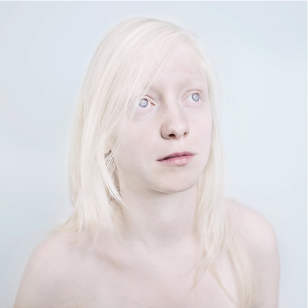 Az albínók is gyönyörűek - galéria