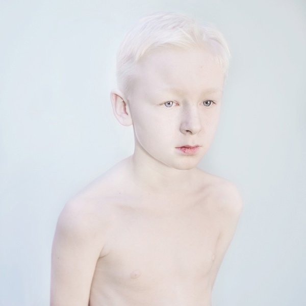 Az albínók is gyönyörűek - galéria