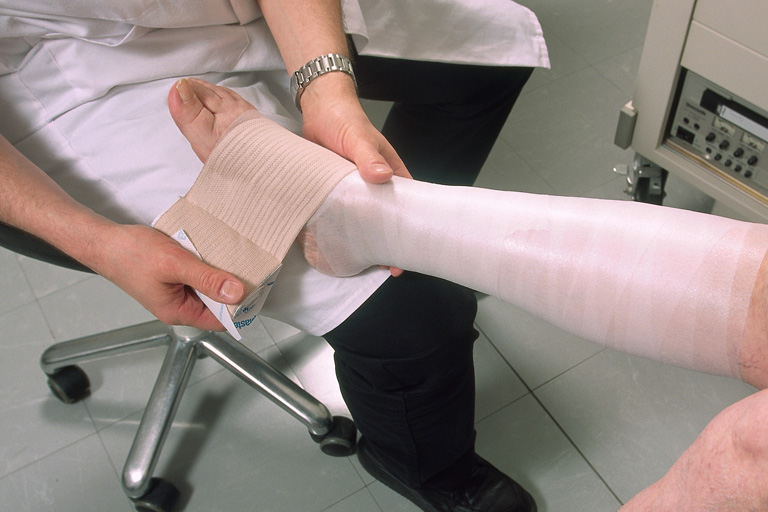 Sebkezelés műtét után - Mennyit kell bekötözni a lábat visszeres műtét után