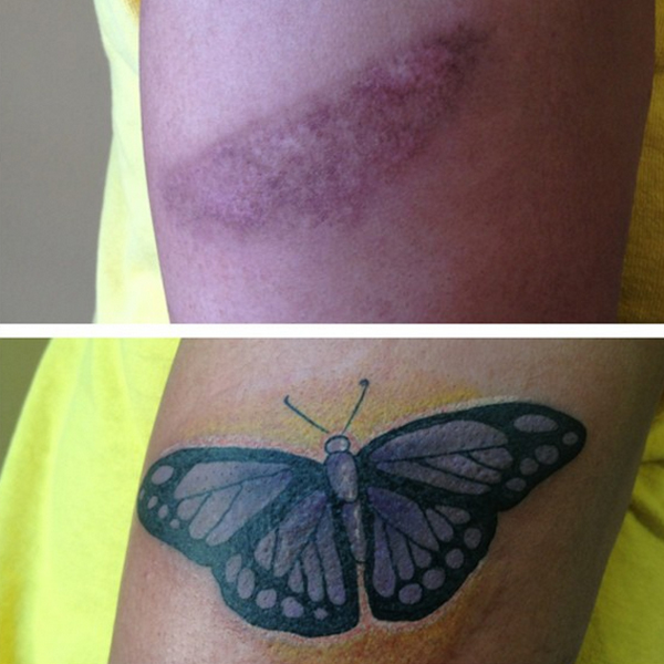 15 tetoválás, amit nem divatból csináltattak - galéria
