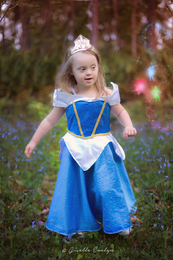 Hercegnőként fotózta Down-szindrómás kislányát