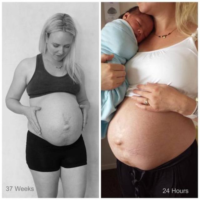 37. hét és 24 órával szülés után