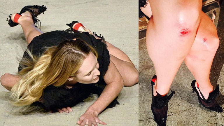 Candice Swanepoel szupermodell hatalmasat esett a kifutón - fotók