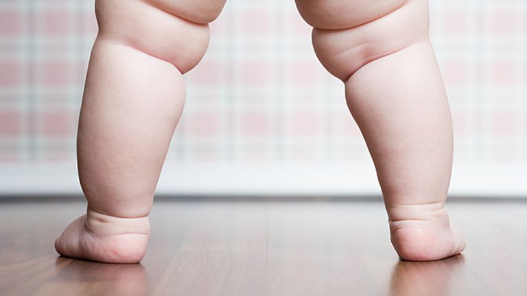 Hároméves kislány a világon a legfiatalabb elhízás miatti cukorbeteg