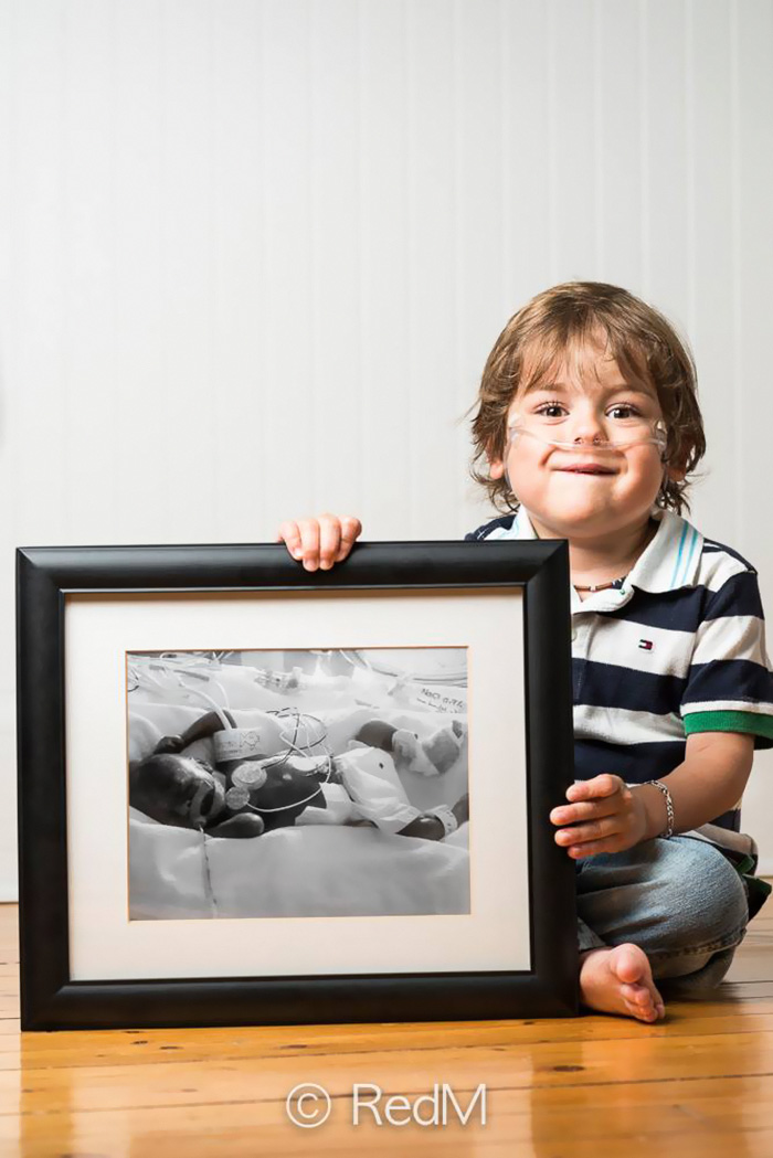 Minden kezdet nehéz: Koraszülött kisbabák most - fotók