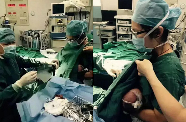 Műtét közben szoptatta meg a kisbabát az ápolónő