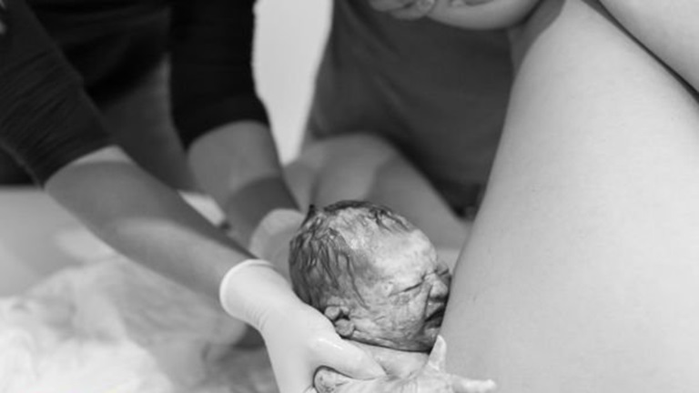 Gyönyörű fotók a születés pillanatáról