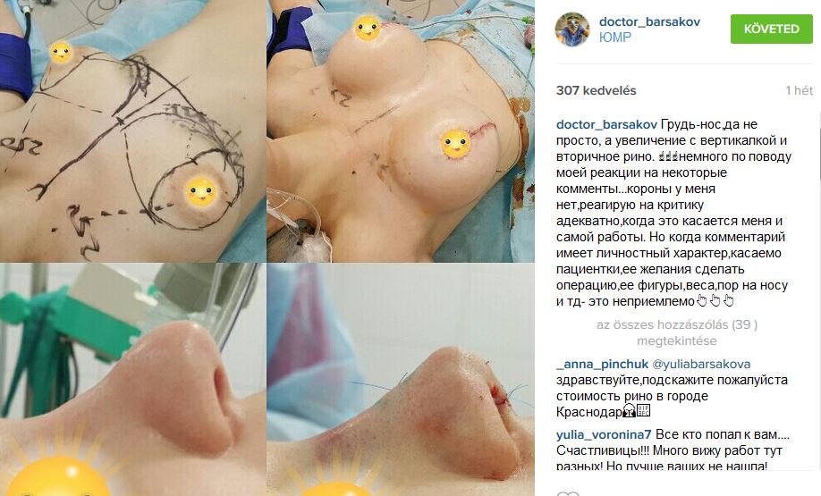 Az orosz plasztikai sebészek meghódították az Instagramot, de mi a gyomrunk felfordul ettől