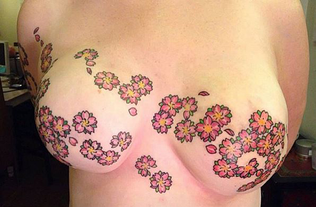 Az Instagram letiltotta a masztektómia utáni tetoválásokat ábrázoló fotókat