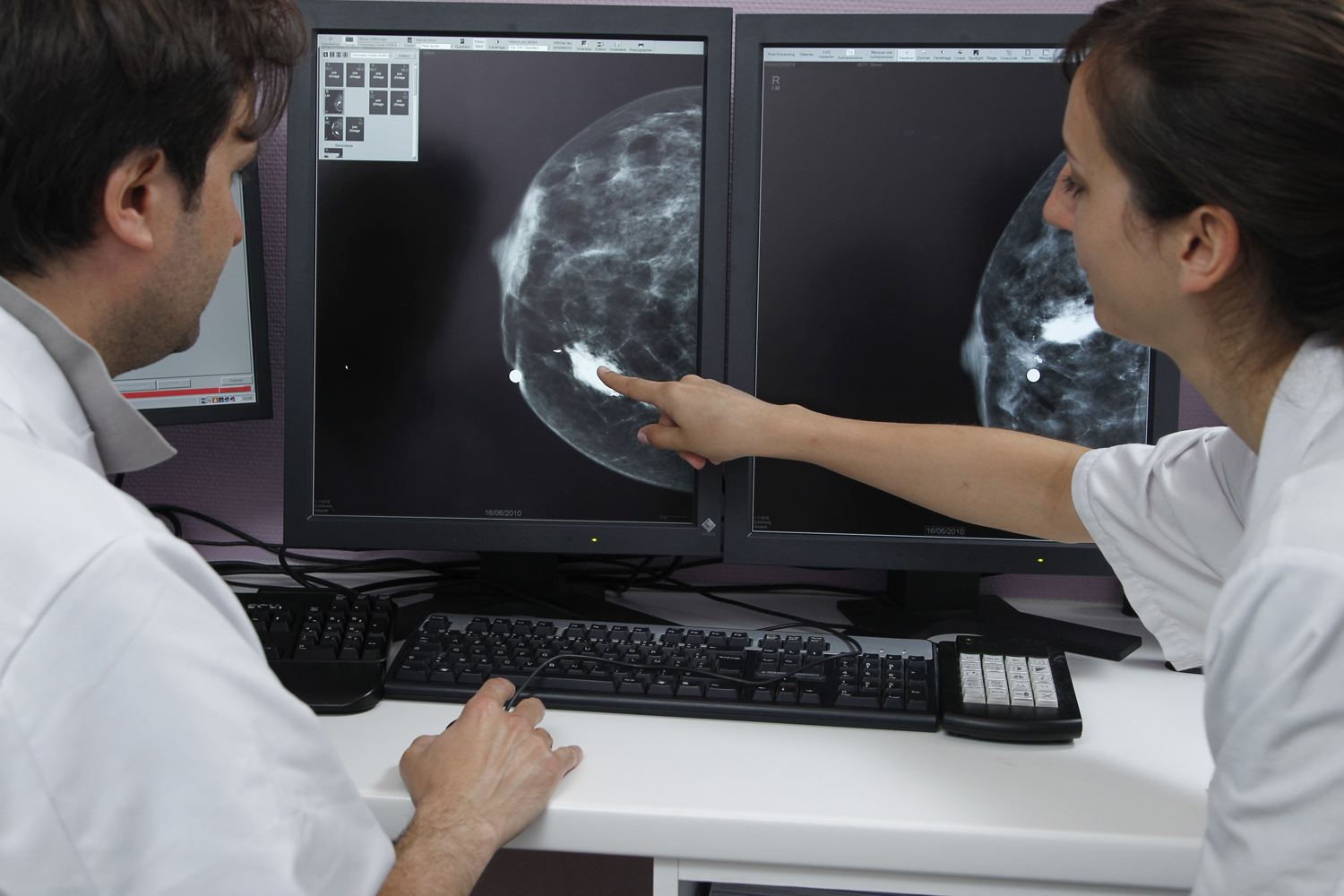 10+1 kérdés, ami felmerül az emberben, ha mammográfiára megy