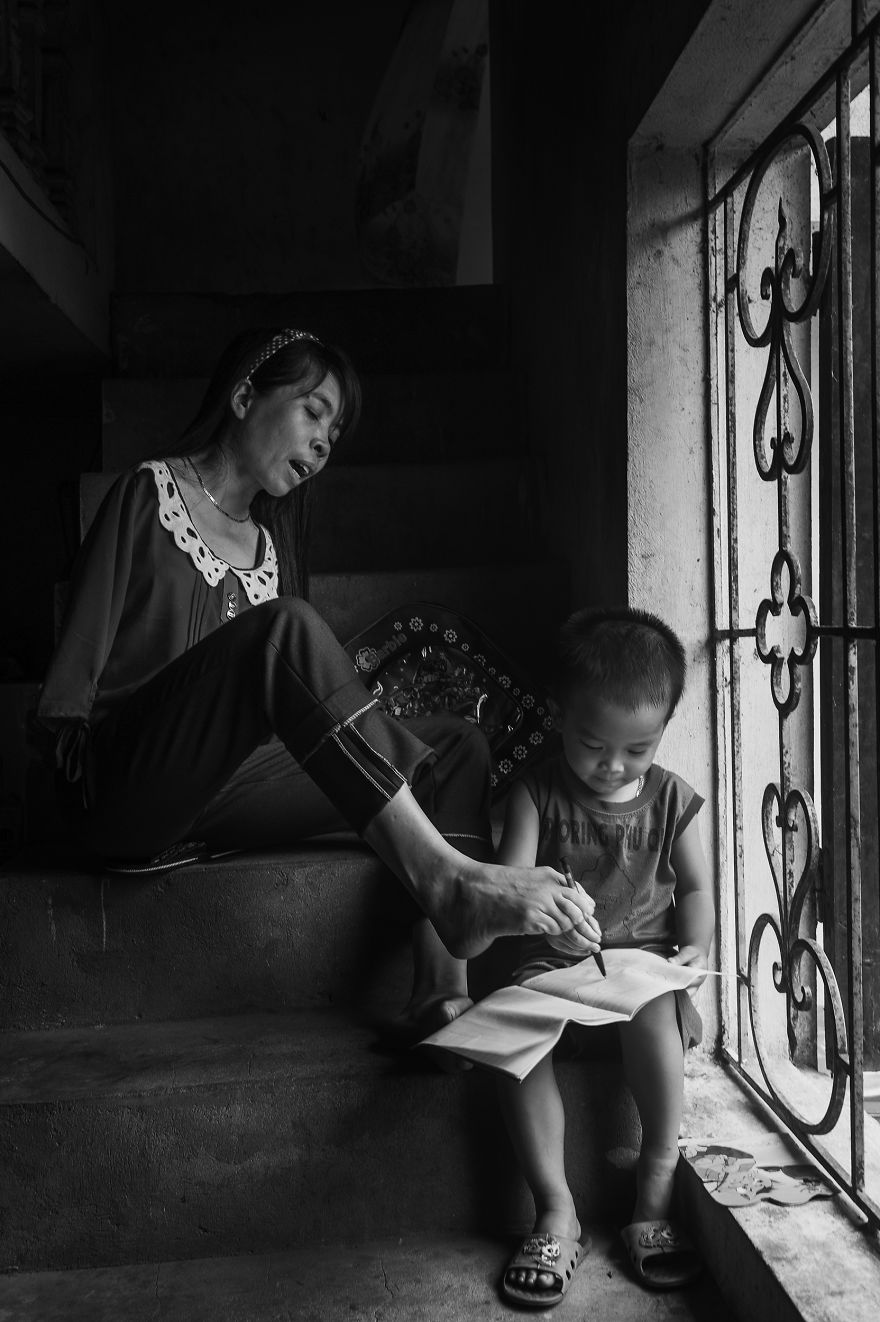 Élet a háború után: szívfacsaró fotósorozat a karok nélküli vietnámi nőről