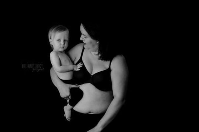 Depresszióval küzdő anyukák vállalták betegségüket megható fotókon