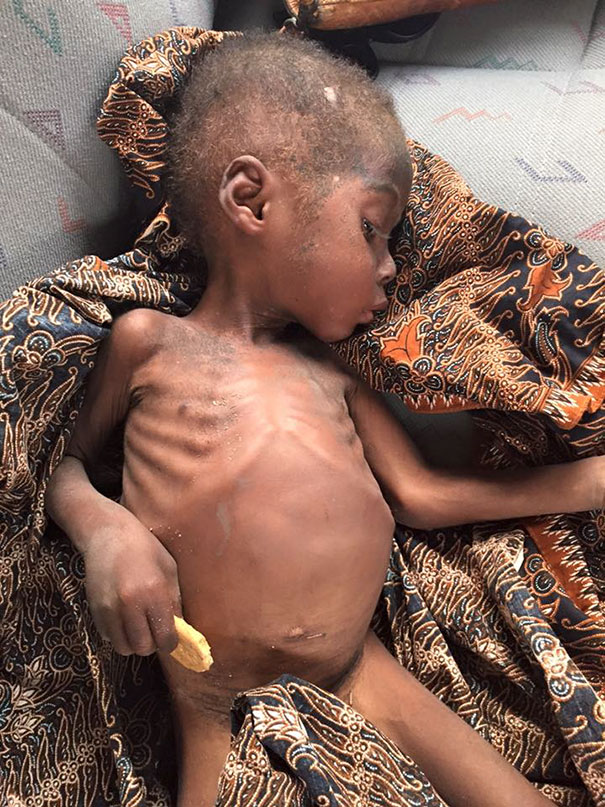 Szívszorító képek: vizet kap az elhagyott nigériai kisfiú