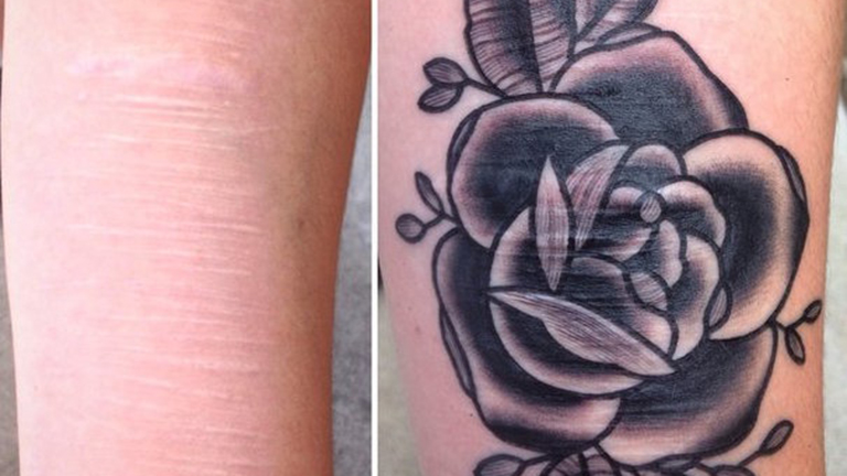 Tetoválásokkal fedi el az erőszak nyomait a művész