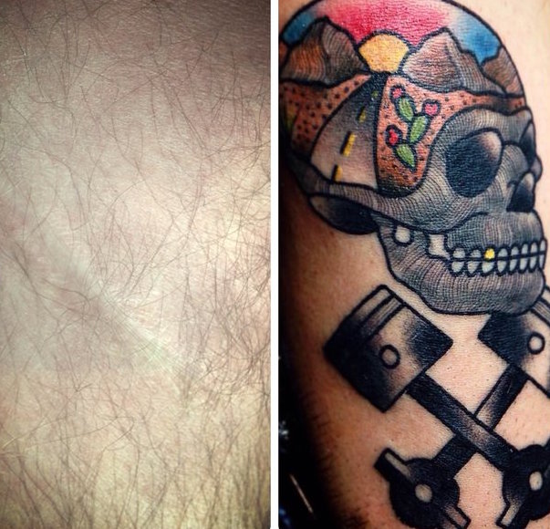 Tetoválásokkal fedi el az erőszak nyomait a művész