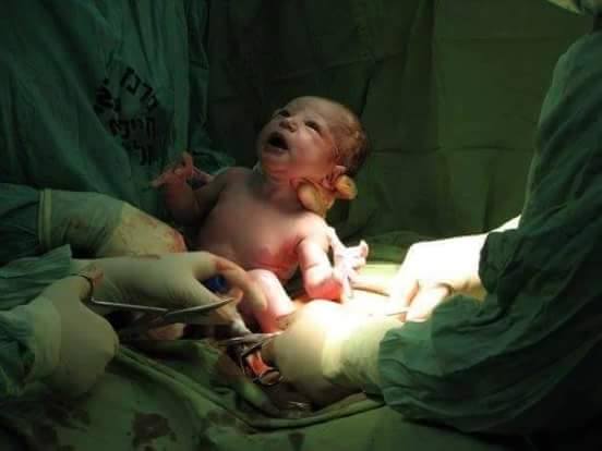 Ilyen a császsármetszés - újabb gyönyörű képek a születésről