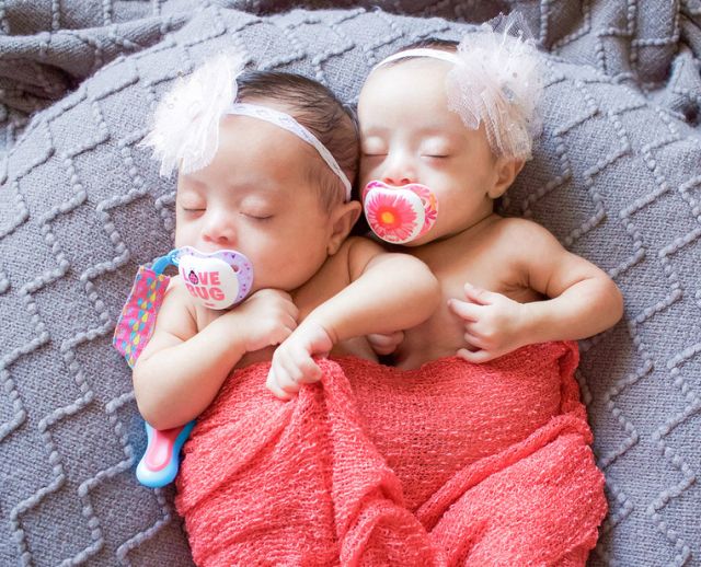 Gyönyörű fotók az újszülött Down-szindrómás ikrekről