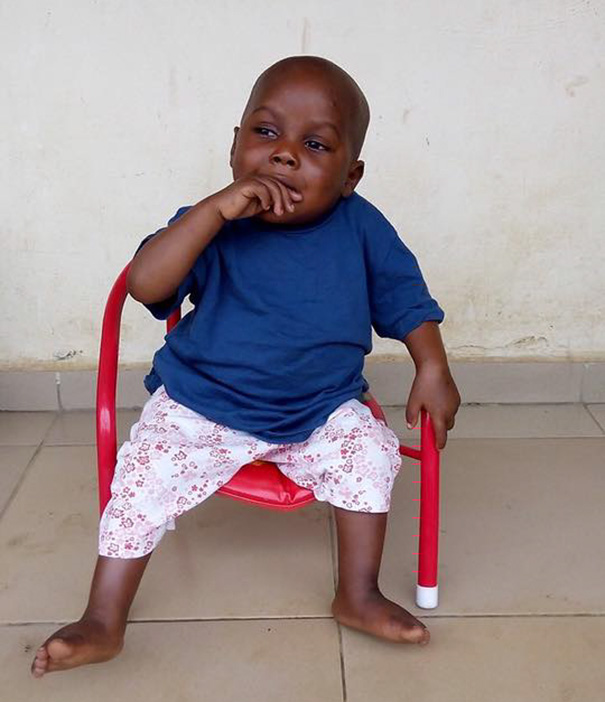 Hihetetlen felépülésen ment át az utcára dobott nigériai kisfiú - képek