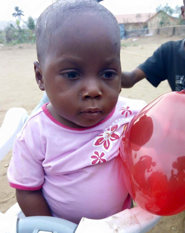 Hihetetlen felépülésen ment át az utcára dobott nigériai kisfiú - képek