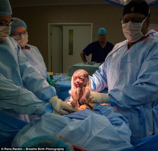 Saját babáját segítette világra az anyuka császármetszés közben - fotók