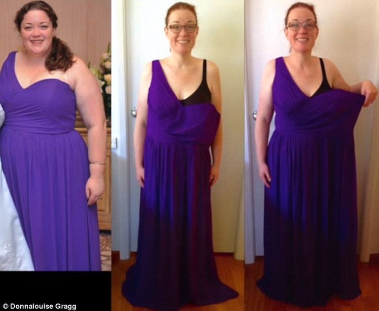 10 hónap alatt 70 kilót fogyott egy nő