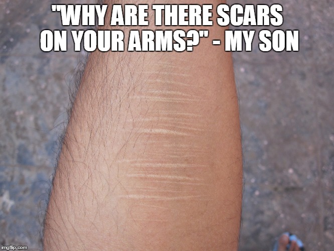 “Apa, miért vannak sebhelyek a karodon?
