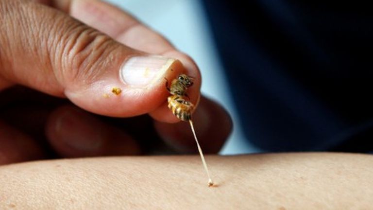 Méhekkel gyógyít egy férfi