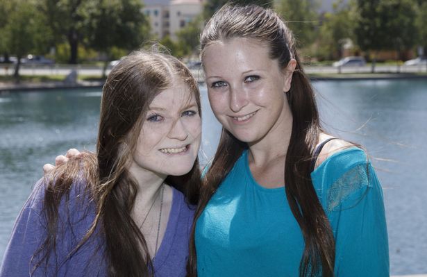 Egymással versenyeztek az anorexiás nővérek, hogy melyikük lesz a soványabb - képek