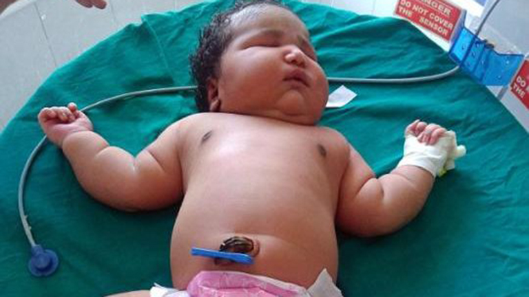 Hétkilós babát szült az indiai nő