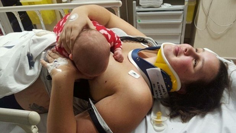 A balesetet szenvedett anyuka elutasította a fájdalomcsillapítót, hogy szoptathasson