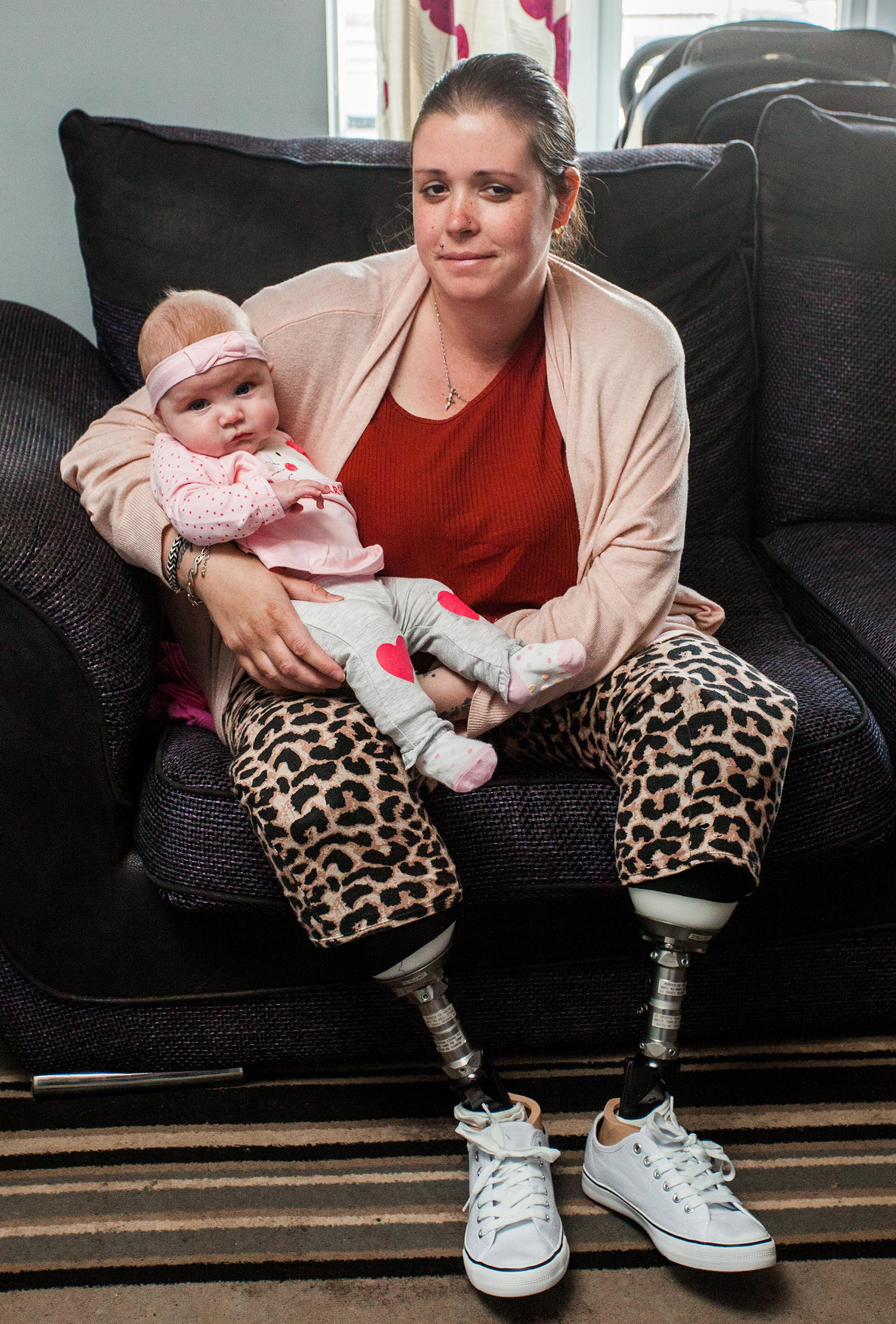 Azért ment kórházba, hogy megszülje nyolcadik gyermekét - lábak nélkül ébredt fel