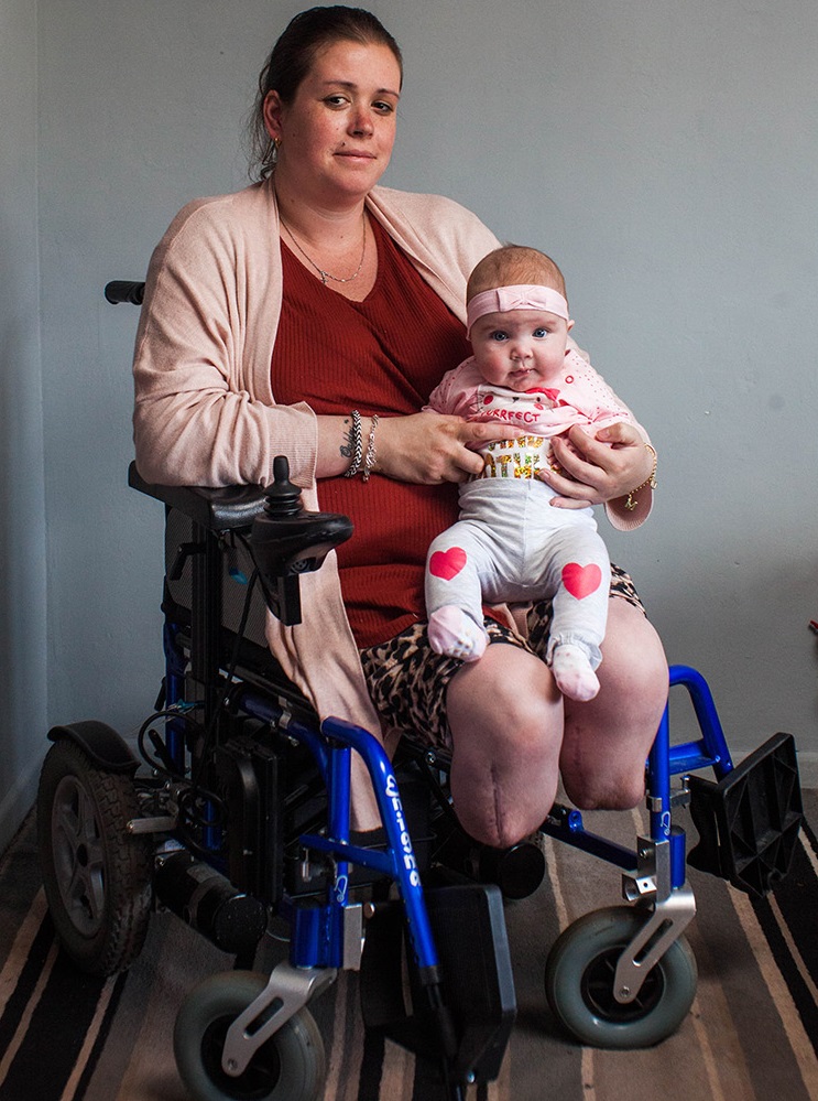 Azért ment kórházba, hogy megszülje nyolcadik gyermekét - lábak nélkül ébredt fel