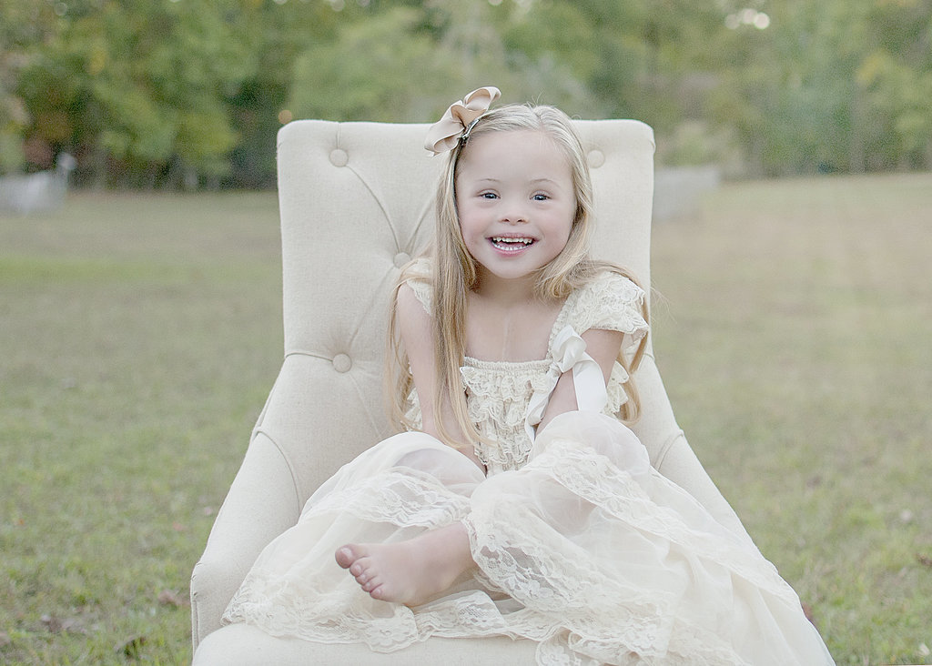 Szívszorító okból készült gyönyörű fotósorozat Down-szindrómás kisgyerekekről