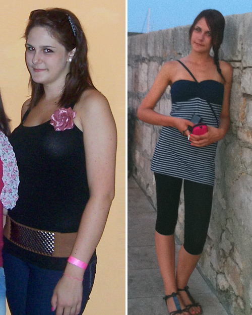 súlycsökkenés 15 kg előtt és után)