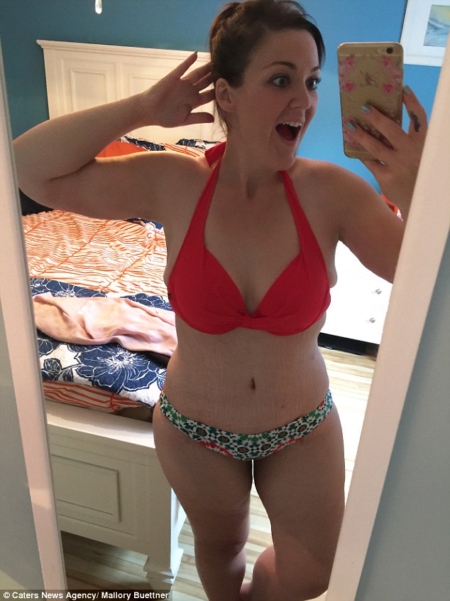 Először húzott bikinit a tanárnő, miután 95 kilót fogyott