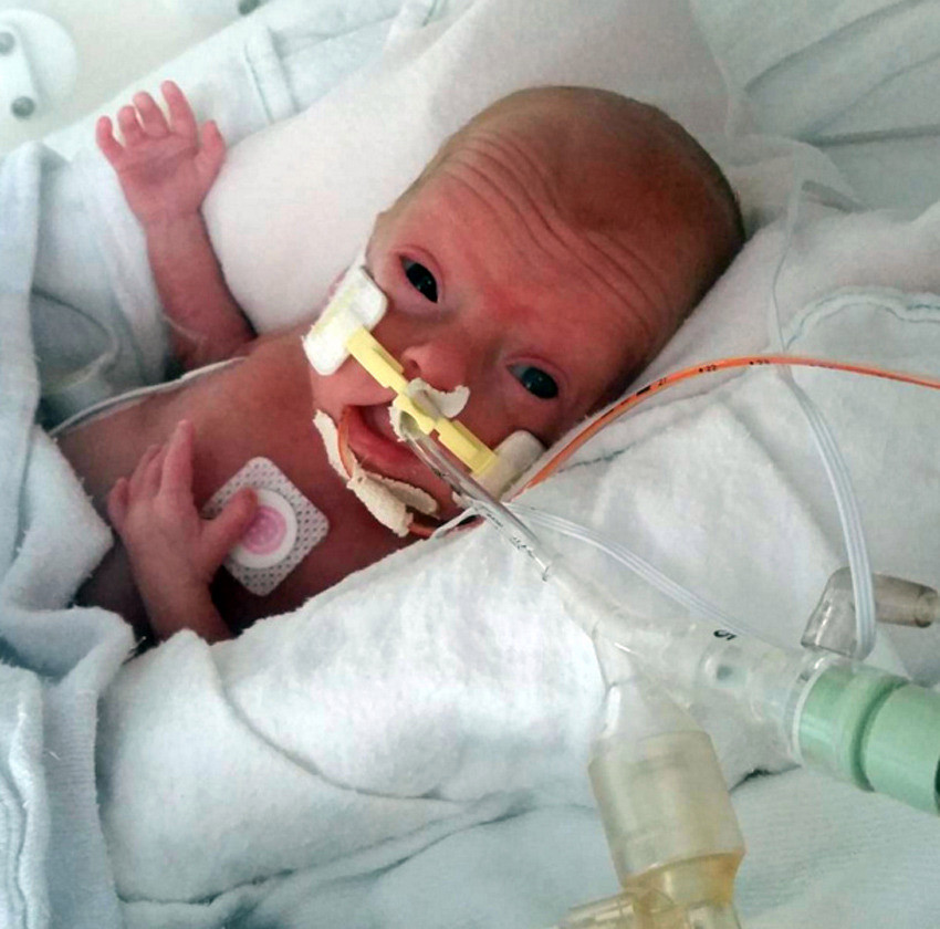 Instagramon dokumentálta az anyuka, hogyan küzd az életéért koraszülött babája