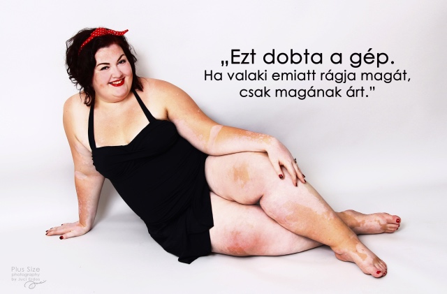 Gyönyörű fotók egy magyar vitiligós plus size nőről, akire öröm ránézni
