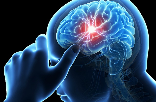 4 ártalmas tévhit a stroke-ról – életet menthet, ha ezt tudod