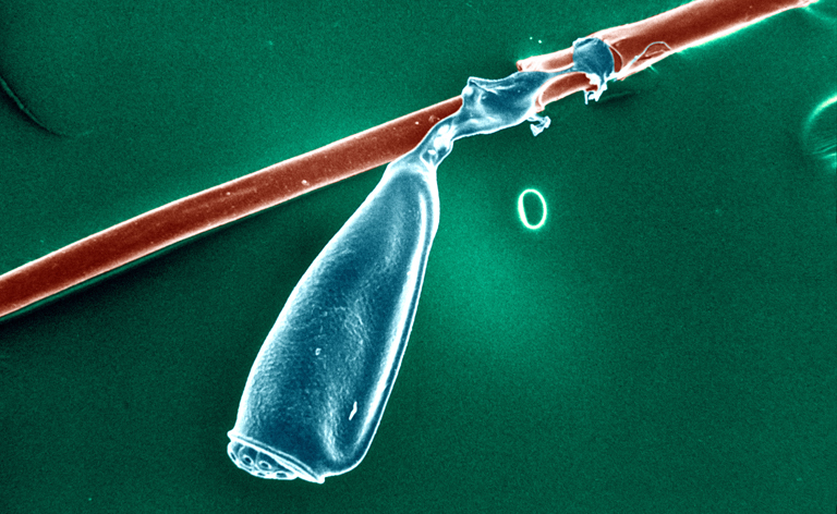 A fetetű petéje mikrószkóp alatt