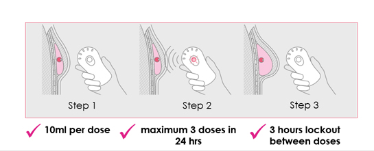 Az implantátum működésének három lépése (Kép: AirXpanders.com)