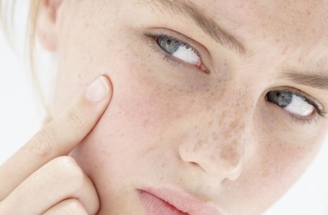 12 tipp az atópiás bőr kezelésére