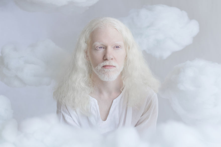 Fotósorozat készült az albínó emberek törékeny szépségéről