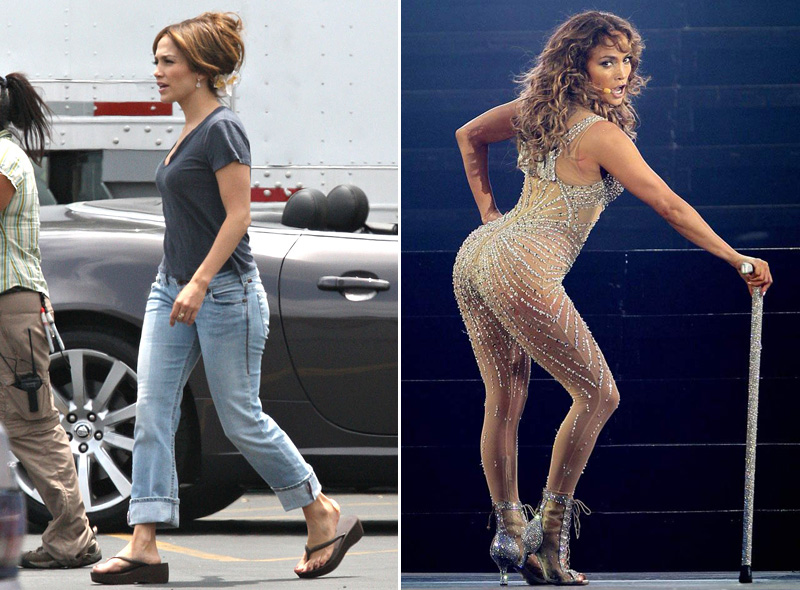 Jennifer Lopez és a brazilian butt lift (Fotó: Profimedia)
