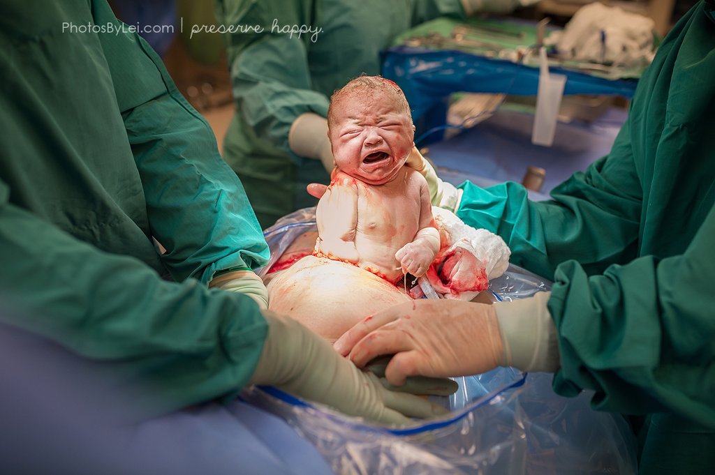 Elképesztő fotók a szülés csodájáról