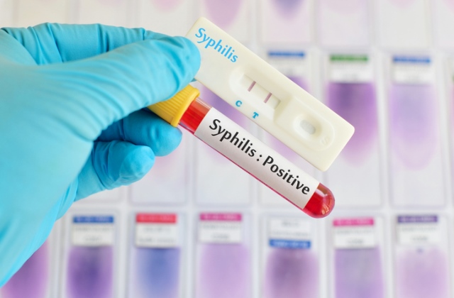 Durván emelkedik a szifilisz-fertőzöttek száma